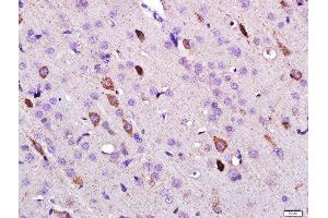 Paraformaldehyde-fixed, paraffin embedded rat brain, Antigen retrieval by boiling in sodium citrate buffer (pH6) for 15min, Block endogenous peroxidase by 3% hydrogen peroxide for 30 minutes, Blocking buffer (normal goat serum) at 37°C for 20min, Antibody incubation with 	Leptin Polyclonal Antibody, Unconjugated  at 1:500 overnight at 4°C, followed by a conjugated secondary and DAB staining.