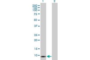 anti-GTP Cyclohydrolase I Feedback Regulator (GCHFR) (AA 1-84) antibody