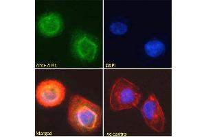 Image no. 6 for anti-Autoimmune Regulator (AIRE) (C-Term) antibody (ABIN184780)