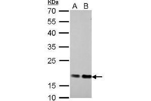 Image no. 1 for anti-Cofilin 1 (CFL1) (Center) antibody (ABIN2855302)