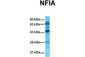 Image no. 2 for anti-Nuclear Factor I/A (NFIA) (Middle Region) antibody (ABIN2777542)