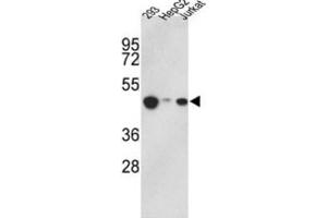Image no. 1 for anti-Histone Aminotransferase 1 (HAT1) antibody (ABIN2995847)