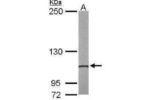 Image no. 4 for anti-Actinin, alpha 4 (ACTN4) (C-Term) antibody (ABIN2855119)