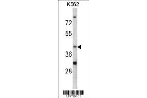 Western Blotting (WB) image for anti-CCR4 Carbon Catabolite Repression 4-Like (CCRN4L) antibody (ABIN2158111)