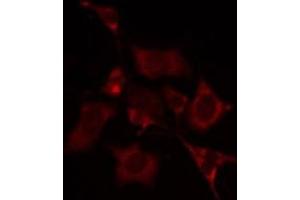 Image no. 1 for anti-Carbonic Anhydrase VA (CA5A) (Internal Region) antibody (ABIN6258659)