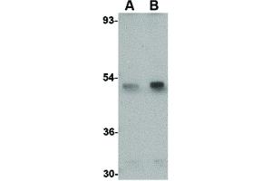 Image no. 2 for anti-Sprouty-Related, EVH1 Domain Containing 1 (SPRED1) (Internal Region) antibody (ABIN6657137)