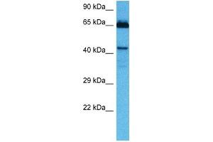 Image no. 2 for anti-Homeobox A10 (HOXA10) (Middle Region) antibody (ABIN2792575)