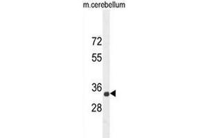 Image no. 3 for anti-Cell Adhesion Molecule 1 (CADM1) (AA 69-98), (N-Term) antibody (ABIN951001)