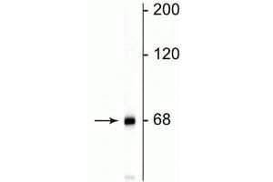 Image no. 2 for anti-Neurofilament, Light Polypeptide (NEFL) antibody (ABIN361352)