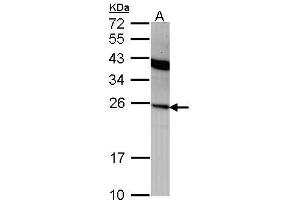 Image no. 1 for anti-Interferon, alpha 2 (IFNA2) (C-Term) antibody (ABIN2856588)