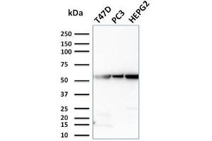 Image no. 1 for anti-Glucose-6-Phosphate Isomerase (GPI) antibody (ABIN6939548)