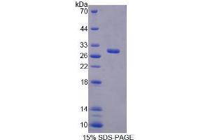 Image no. 1 for Replication Factor C (Activator 1) 4, 37kDa (RFC4) (AA 1-213) protein (His tag) (ABIN6239665)