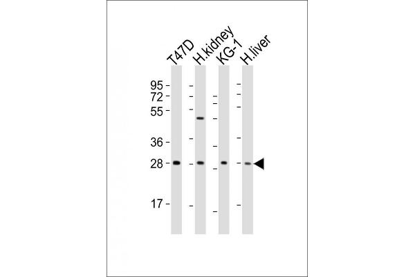 TIM3 anticorps  (AA 167-194)