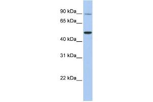 Image no. 1 for anti-Transient Receptor Potential Cation Channel, Subfamily V, Member 5 (TRPV5) (N-Term) antibody (ABIN2783755)
