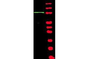 Image no. 1 for anti-BRCA1 Interacting Protein C-terminal Helicase 1 (BRIP1) (AA 92-104), (Isoform 1) antibody (ABIN117916)