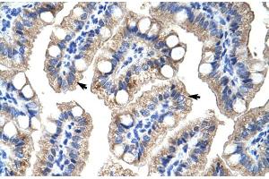 Image no. 3 for anti-Zinc Finger Protein 785 (ZNF785) (C-Term) antibody (ABIN2775096)