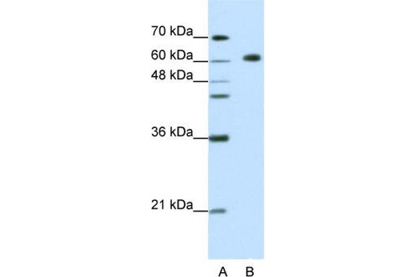anti-Glucocorticoid Modulatory Element Binding Protein 2 (GMEB2) (C-Term) antibody