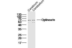 Image no. 3 for anti-Optineurin (OPTN) (AA 341-440) antibody (ABIN2178063)