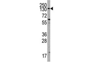 Image no. 5 for anti-Phosphoinositide-3-Kinase, Catalytic, alpha Polypeptide (PIK3CA) (AA 504-533) antibody (ABIN3028924)
