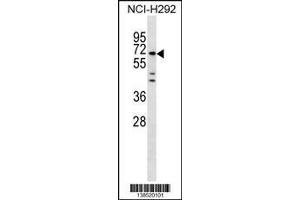 Image no. 1 for anti-Mesoderm Induction Early Response 1, Family Member 3 (MIER3) (AA 284-312) antibody (ABIN1538243)