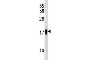Image no. 1 for anti-CD70 Molecule (CD70) (AA 72-101) antibody (ABIN3030417)