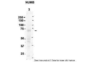 Image no. 2 for anti-Numb Homolog (NUMB) (C-Term) antibody (ABIN2788064)