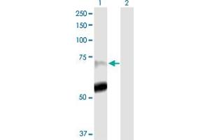 Image no. 1 for anti-Peptidyl Arginine Deiminase, Type IV (PADI4) (AA 1-663) antibody (ABIN525271)