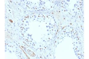 Image no. 3 for anti-Wilms Tumor 1 (WT1) (AA 1-181) antibody (ABIN6940900)
