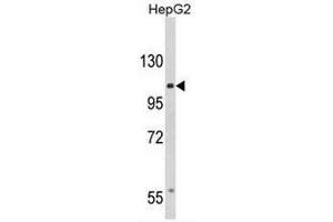 Image no. 2 for anti-Calcium Channel, Voltage-Dependent, alpha 2/delta Subunit 3 (CACNA2D3) (C-Term) antibody (ABIN950991)