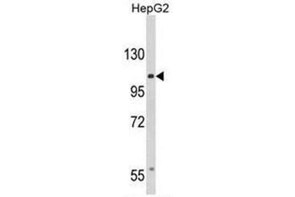 CACNA2D3 anticorps  (C-Term)