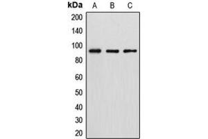 Western blot analysis of DGK beta expression in HT29 (A), MCF7 (B), HeLa (C) whole cell lysates.