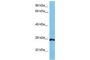Image no. 3 for anti-General Transcription Factor IIF, Polypeptide 2, 30kDa (GTF2F2) (Middle Region) antibody (ABIN2777297)
