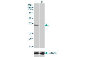 Image no. 2 for anti-Tissue Specific Transplantation Antigen P35B (TSTA3) (AA 222-321) antibody (ABIN563274)
