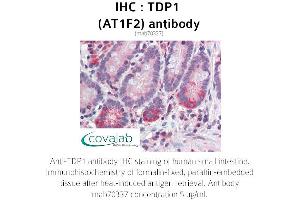 Image no. 1 for anti-Tyrosyl-DNA Phosphodiesterase 1 (TDP1) (AA 1-298) antibody (ABIN1724362)