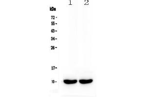 Image no. 1 for anti-Secretoglobin, Family 1A, Member 1 (Uteroglobin) (SCGB1A1) (AA 22-96) antibody (ABIN5692959)