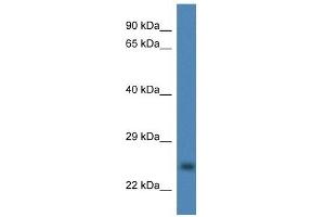 Image no. 1 for anti-Copper Chaperone For Superoxide Dismutase (CCS) (Middle Region) antibody (ABIN926646)
