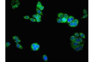 Immunofluorescent analysis of PC-3 cells using ABIN7145043 at dilution of 1:100 and Alexa Fluor 488-congugated AffiniPure Goat Anti-Rabbit IgG(H+L)