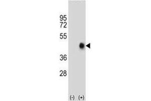 Image no. 2 for anti-TNF Receptor Superfamily, Member 6 (FAS) (AA 185-211) antibody (ABIN3030902)