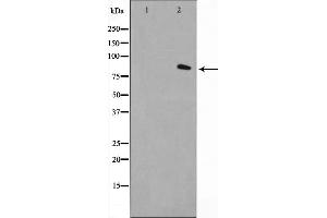 Image no. 3 for anti-Fibroblast Activation Protein, alpha (FAP) (Internal Region) antibody (ABIN6261679)