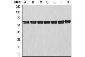 Image no. 2 for anti-TNF Receptor-Associated Factor 3 (TRAF3) (Center) antibody (ABIN2707194)