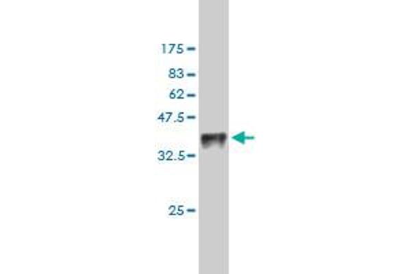 anti-Testis-Specific Kinase 1 (TESK1) (AA 266-365) antibody