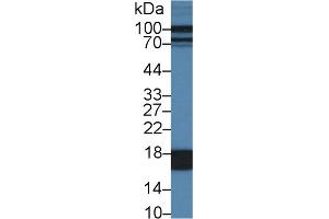 Image no. 2 for anti-Fatty Acid Binding Protein 1, Liver (FABP1) (AA 1-127) antibody (ABIN1862467)