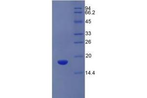 Image no. 3 for Solute Carrier Family 3 (Activators of Dibasic and Neutral Amino Acid Transport), Member 2 (SLC3A2) ELISA Kit (ABIN6720502)