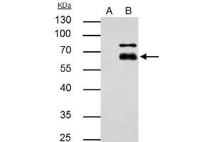 Image no. 4 for anti-Matrix Metallopeptidase 8 (Neutrophil Collagenase) (MMP8) (Center) antibody (ABIN2856104)