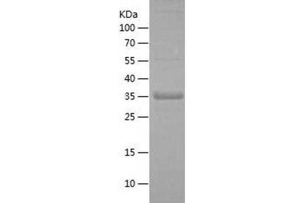 IRF2BP2 Protein (AA 72-174) (IF2DI tag)