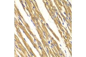 Image no. 3 for anti-Superoxide Dismutase 2, Mitochondrial (SOD2) antibody (ABIN3021904)