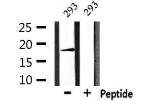 Image no. 1 for anti-Retinoic Acid Receptor Responder (Tazarotene Induced) 3 (RARRES3) antibody (ABIN6264643)