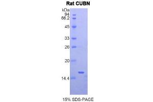 Image no. 1 for Cubilin (Intrinsic Factor-Cobalamin Receptor) (CUBN) (AA 98-207) protein (His tag) (ABIN1877773)