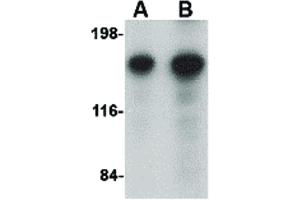 Image no. 2 for anti-Ca++-Dependent Secretion Activator (CADPS) (N-Term) antibody (ABIN6656946)