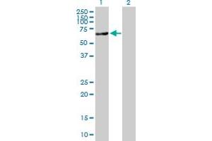 Western Blot analysis of ACSS2 expression in transfected 293T cell line by ACSS2 MaxPab polyclonal antibody.